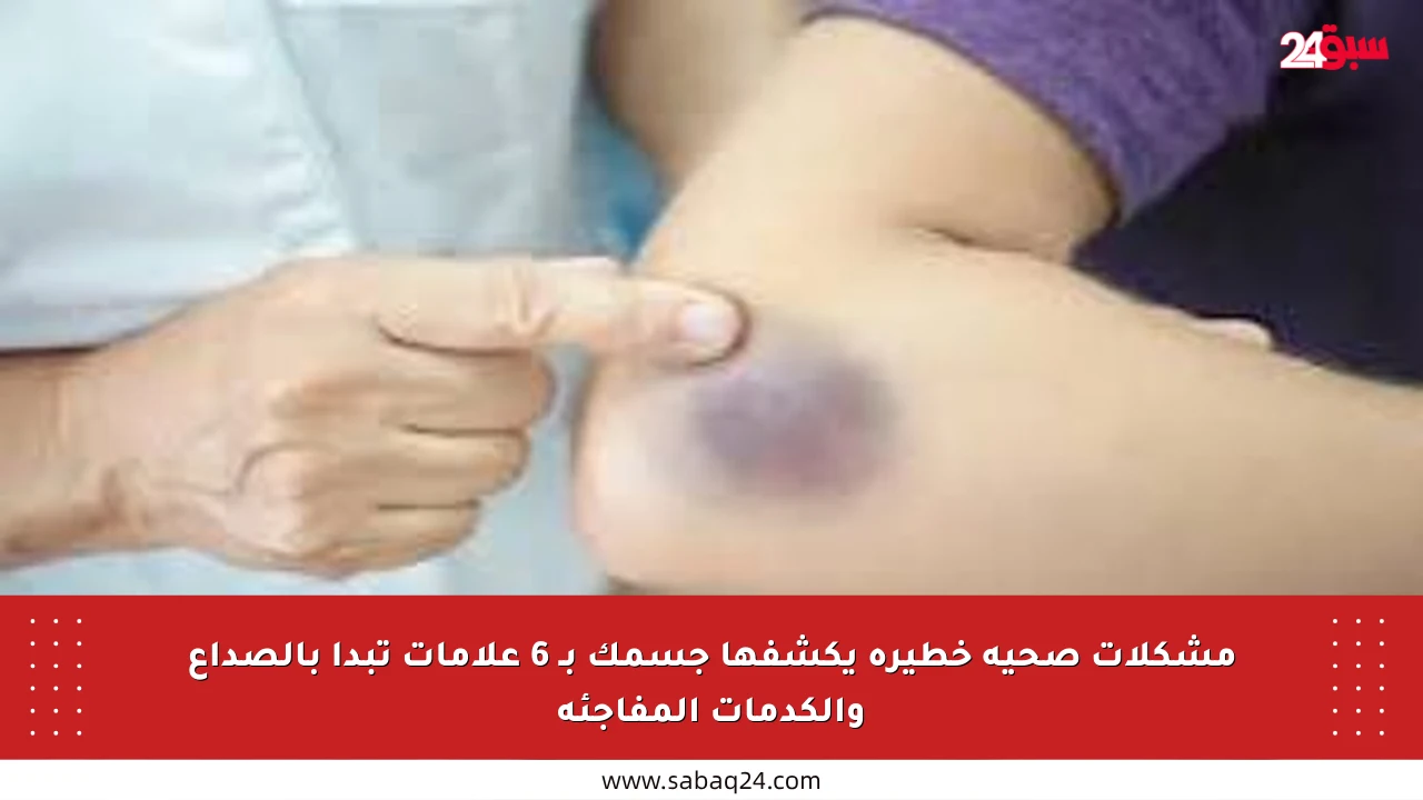 مشكلات صحية خطيرة يكشفها جسمك بـ 6 علامات تبدأ بالصداع والكدمات المفاجئة